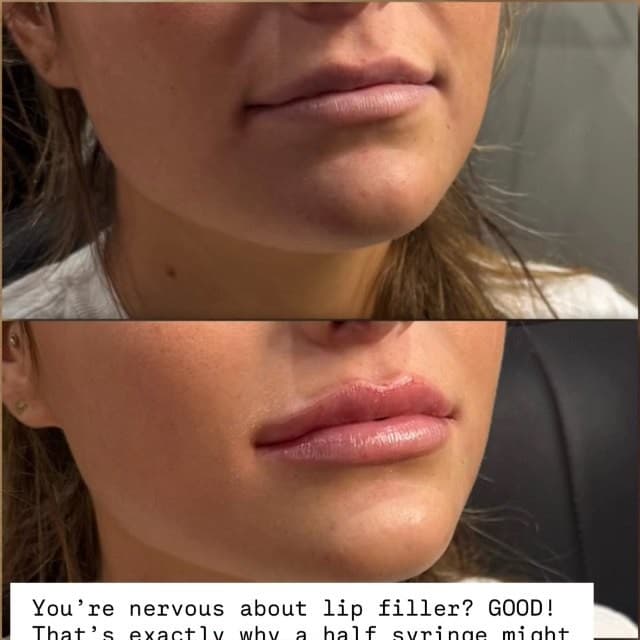 Summer mini-lip special